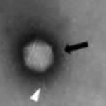 Automated Adenovirus Purity Analysis Speeds Viral-based Gene Therapy Process Development