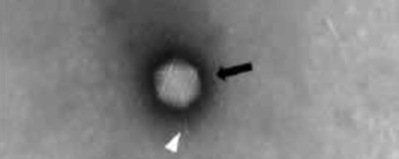 Automated Adenovirus Purity Analysis Speeds Viral-based Gene Therapy Process Development